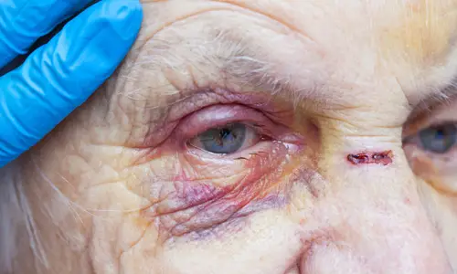 elderly woman after being abused by hospital staff